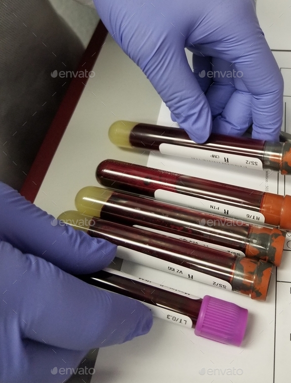 Blood! Vials of Blood! Phlebotomy! Stock Photo by AZBLT PhotoDune