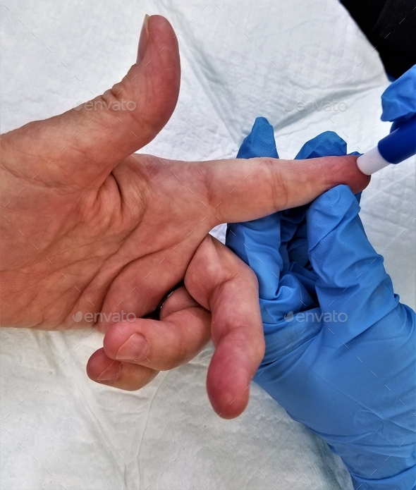 Diabetes Testing! Finger Prick! Blood Glucose Testing! Stock Photo by AZBLT