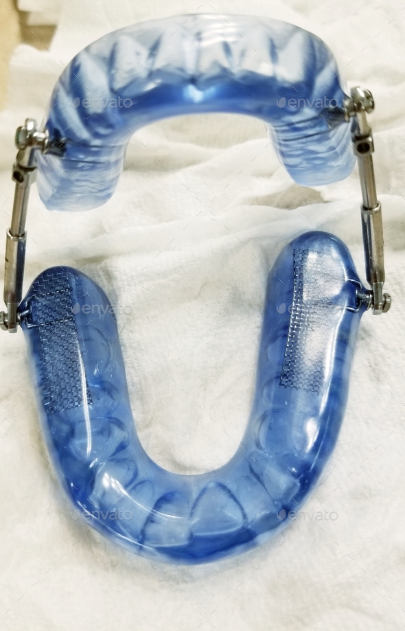 Obstructive Sleep Apnea! Mandibular Oral Device! Stock Photo by AZBLT