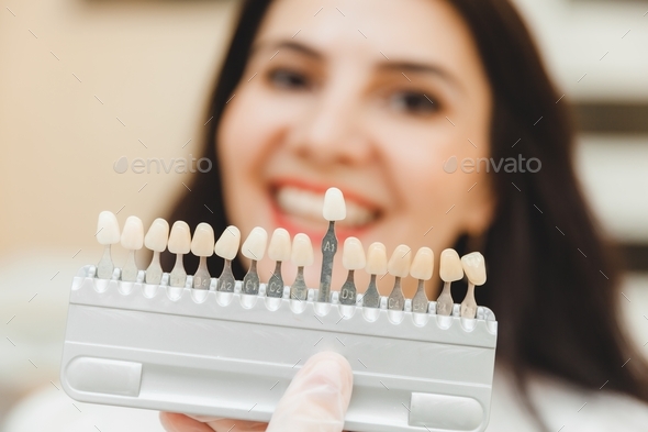 Selection of the correct tooth color for professional cosmetic whitening at the dentist.