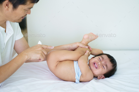 Asian father applying topical cream to baby boy for skin care to relief diaper rash itching.