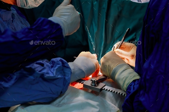 Surgeon hands are tying a knot during the open heart procedure chest during heart surgery