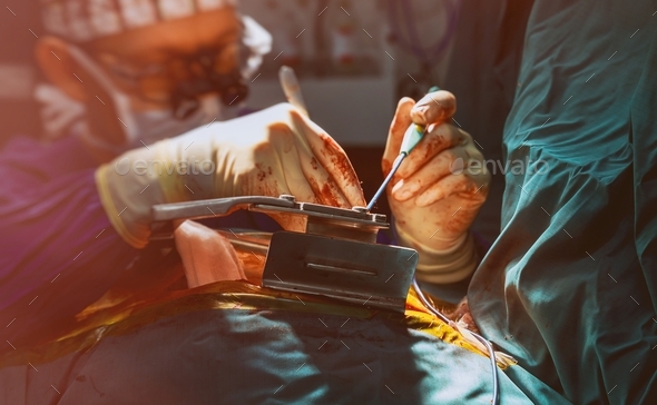 Heart valve replacement surgery during open-heart surgery in operating room