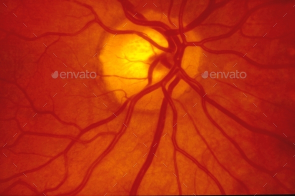 Human Retina - Stock Photo - Images