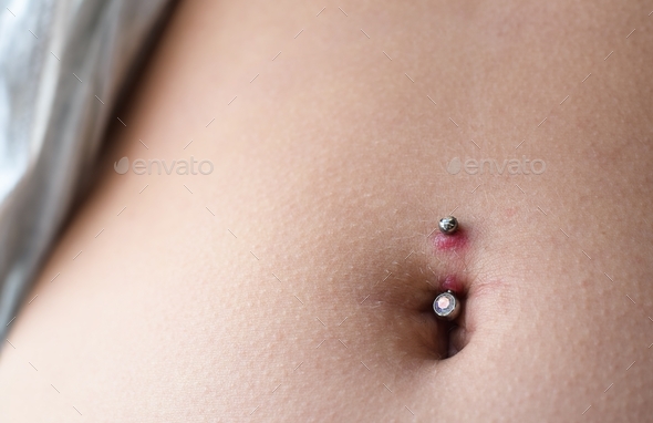 Closeup on infected belly button piercing