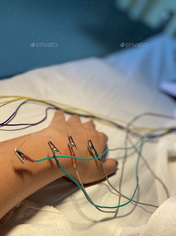 ElectroAcupuncture.Traditional Chinese acupuncture and Electro