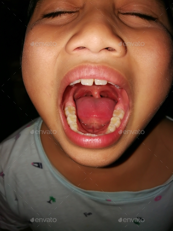 Young child showing sore throat to the doctor.