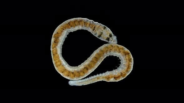 Ophidonais serpentina worm under a microscope, Oligochaeta Subclass alt