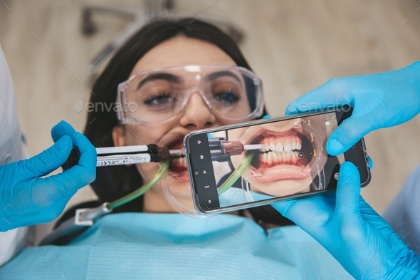 Dental care procedure at stomatology cabinet, medical assistant taking teeth photo using smartphone