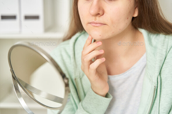 Young teenage female with acne looking at mirror and sees pimples on skin