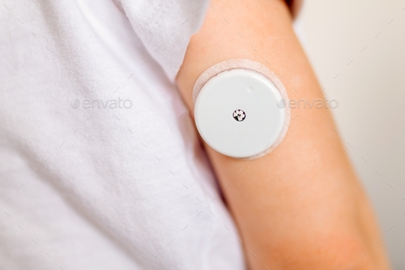 CGM -system of continuous monitoring of glucose on child\'s arm.