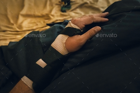 Man with his broken arm. arm in cast. - Stock Photo - Images