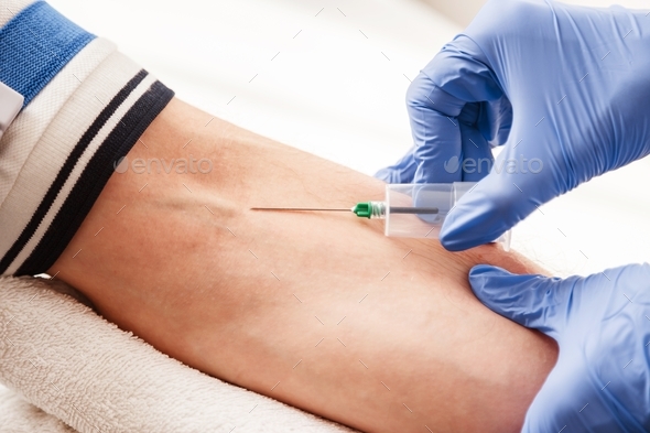 The nurse draws blood from a vein for test.