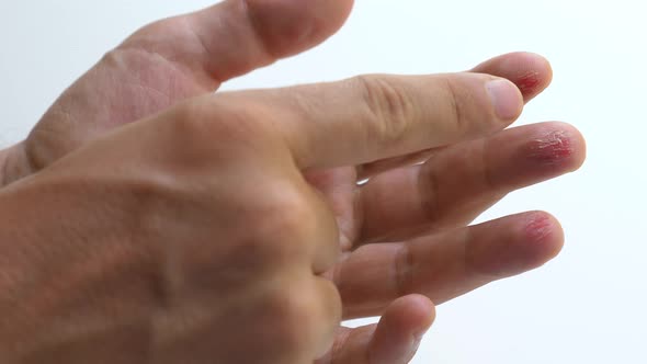 Damaged Male Arm alt