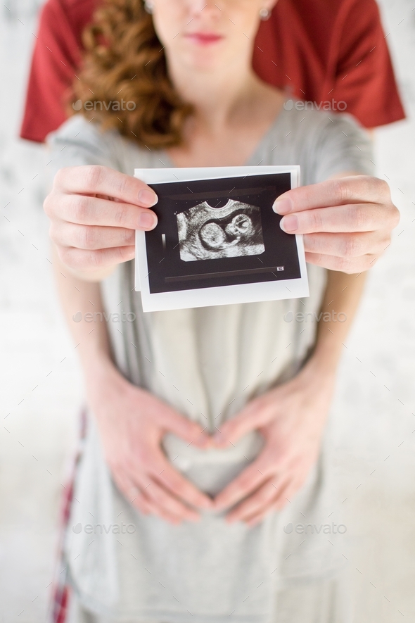 Pregnant woman's belly and ultrasound in hands on foreground. Man make heart from hands on belly on
