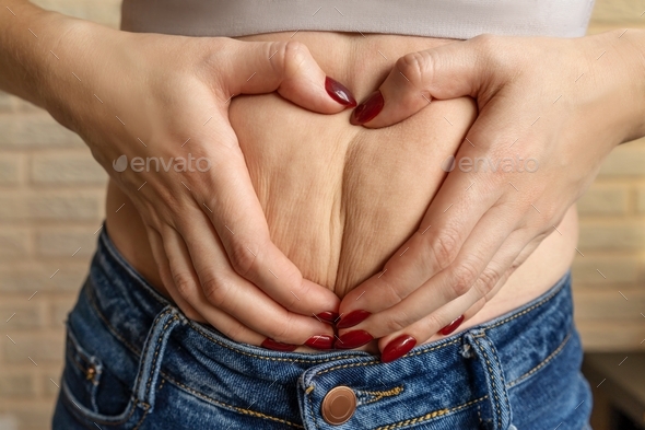 Woman holding fold of skin, cellulite on female body, beige background. Hands make heart.
