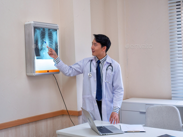 At hospital hall room doctor stand hang chest x-ray film on lighting box and explain lung situation
