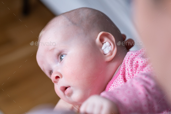 Caucasian baby with medication in ear. Infection treatment