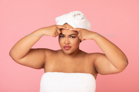 Problem skin. Black body positive woman popping pimple on forehead while posing over pink background