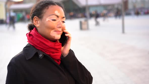 Beautiful African Girl with Vitiligo Standing on the Street alt