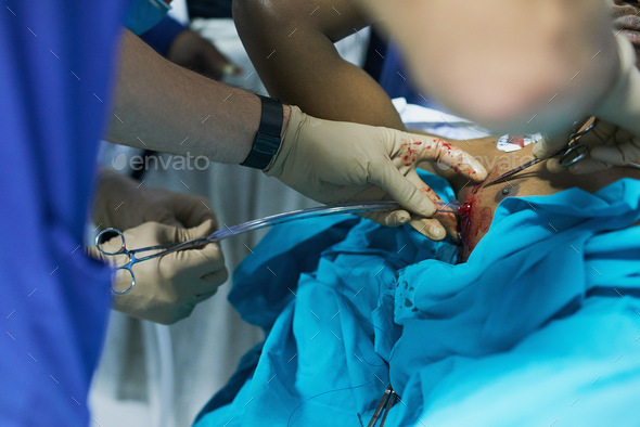 Cropped shot of a doctor inserting a tube into a patients chest in an emergency room