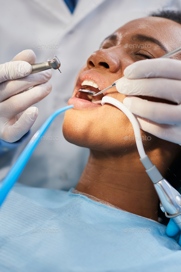 Close-up of African American woman during dental drill procedure at dentist's office.