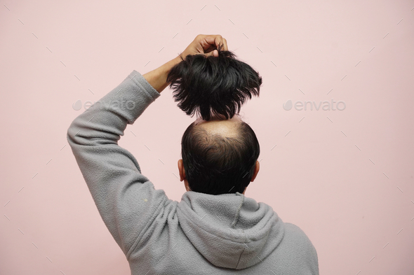 Closeup of a half bald male removing his wig while wearing a