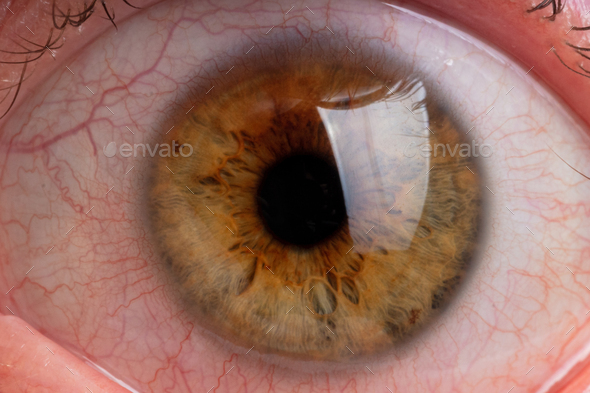 human pupil close up, blood vessels in the white of the eye