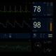 Cardiac Monitor 4K (20 curves) - VideoHive Item for Sale