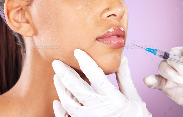 Beauty, aesthetic and lip filler woman collagen treatment with professional cosmetic syringe zoom.