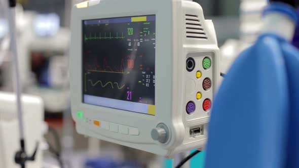 Heart beat of a patient on the screen of computers during operation in the hospital. alt