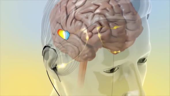 3D Animated representation of the functioning of brain auditory signals ...