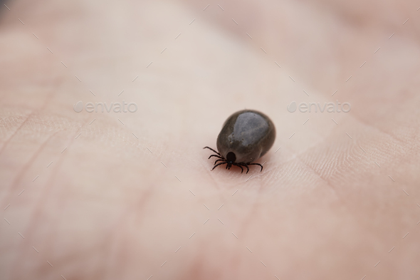 Tick on human hand - Stock Photo - Images