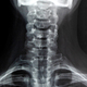 Medical X ray of a female neck, jaw and spine - PhotoDune Item for Sale