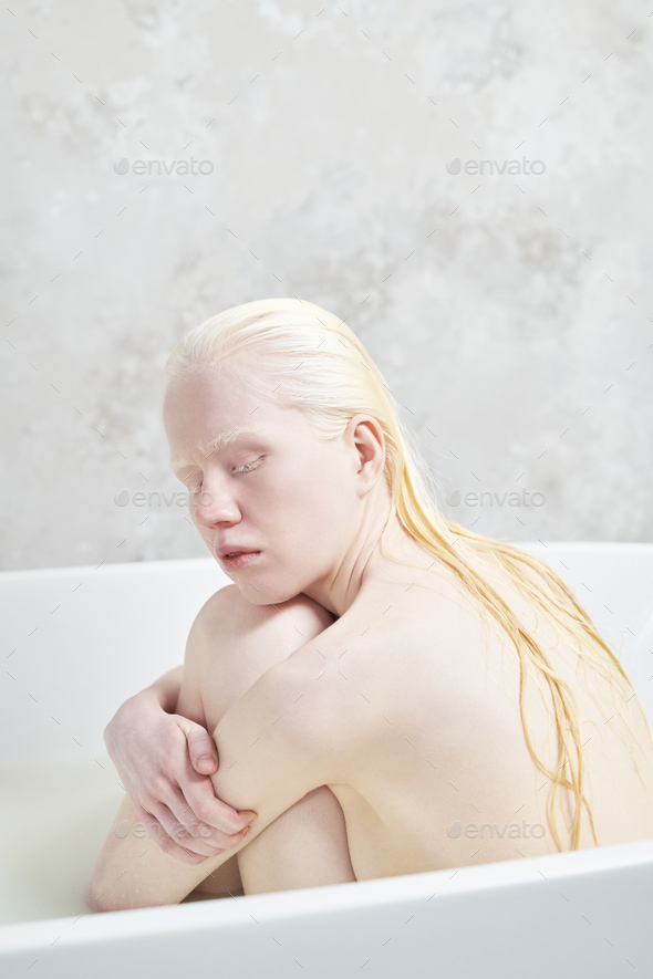 naked albino girl Unknown albino girl : r/Albino_Porn