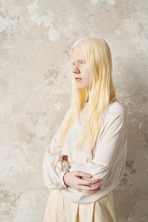 Young albino woman in white cotton casualwear standing by marble wall - Stock Photo - Images