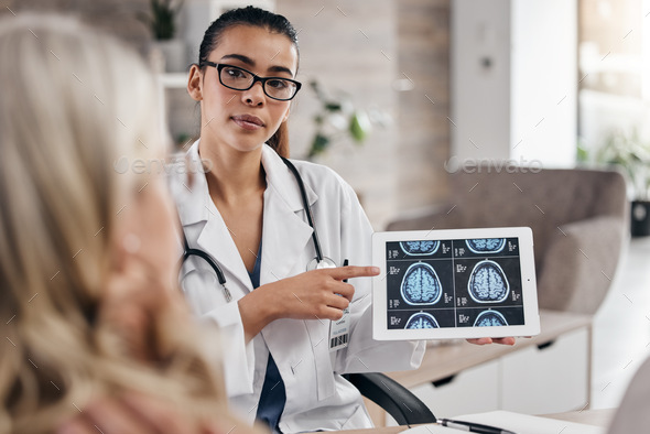 Neurology, woman and doctor pointing at tablet, mri brain scan or xray diagnosis for cancer. Health