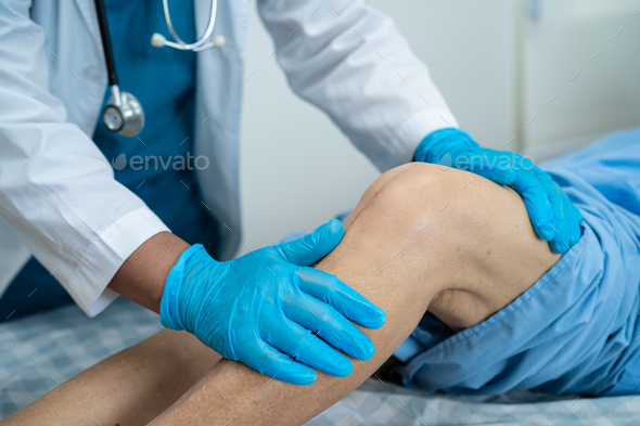 Asian Senior Patient Show Her Scars Surgical Total Knee Joint Replacement Stock Photo By Chormail