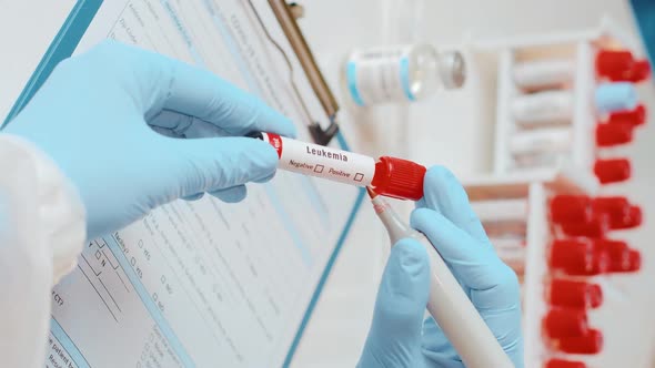 Vertical Footage of Doctor Holds Hand Blood Sample Tube for Leukemia Cells Test alt