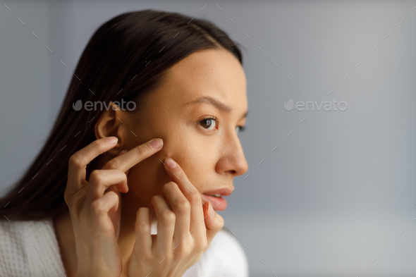  Portrait of girl removing pimples in the bathroom. Beauty and health of the problematic skin.