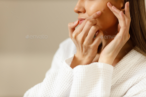 examines pimples on her face close up. Problematic skin on the face, acne. girl removing pimples  - Stock Photo - Images