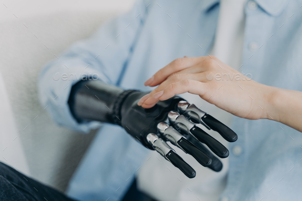 Hands of handicapped girl setting up her bionic arm and pressing buttons. Robotic bionic prosthesis.