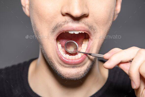 Person with mirror in mouth is checking the backside of front teeth to see if there is caries