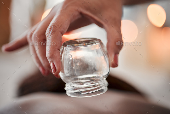 Cupping therapy, glass vacuum cup in hand and woman at spa, therapist with deep tissue massage and