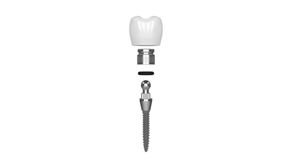 Mini dental implant installation over white background