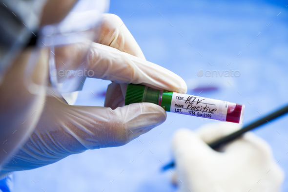 Selective focus of medical worker's hands holding a blood test tube with 