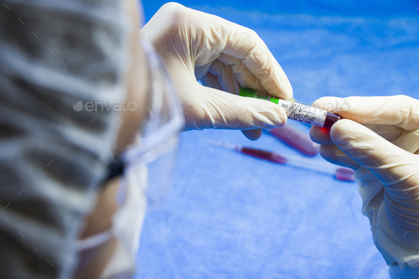 Selective focus of medical worker\'s hands holding a blood test tube with \