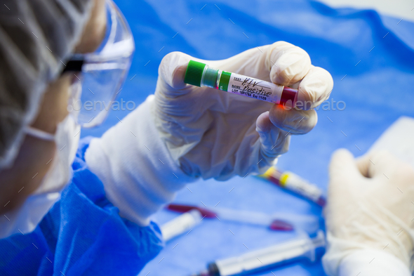 Selective focus of medical worker\'s hands holding a blood test tube with \