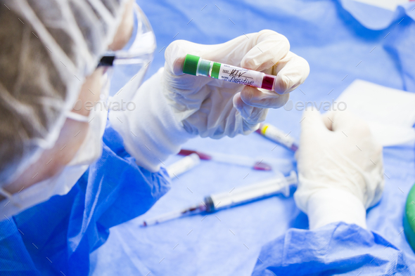 Closeup of a doctor in latex gloves holding an HIV POSITIVE test tube