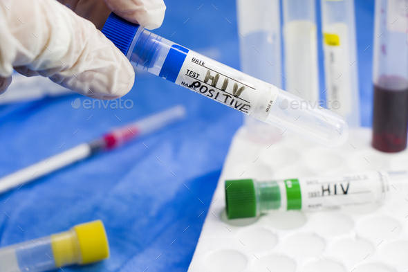 Selective focus of a hand in gloves holding a blood test tube with \